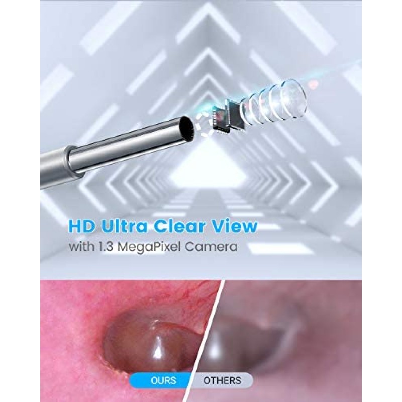 Anykit Herramienta de eliminación de cera para oídos, otoscopio HD para Android y PC, no para iPhone/iPad, cámara de visión ultra clara con removedor de cera, endoscopio de oído con luces LED, cámara de limpieza de oídos con cuchara para oídos