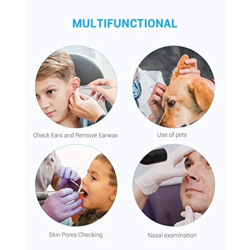 Anykit Herramienta de eliminación de cera para oídos, otoscopio HD para Android y PC, no para iPhone/iPad, cámara de visión ultra clara con removedor de cera, endoscopio de oído con luces LED, cámara de limpieza de oídos con cuchara para oídos